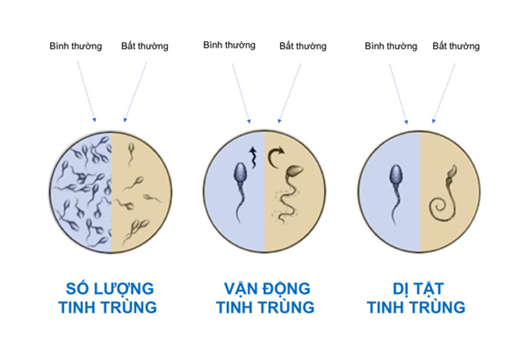 Tinh trùng yếu là tình trạng số lượng, chất lượng thấp, khả năng di chuyển kém