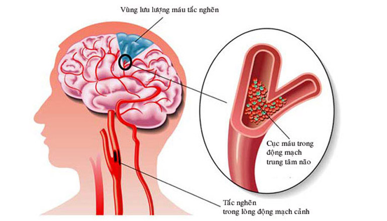 dau-dau-cang-thang-2.jpg