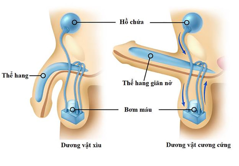 Phẫu thuật trị liệt dương hoàn toàn